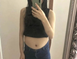 腹部吸脂过的小姐姐照片,见证腹部吸脂术后蜕变之美